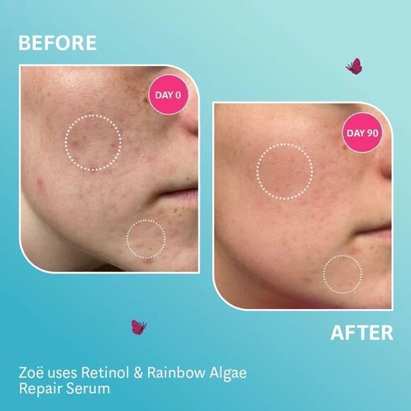 Retinol & Rainbow Algae Repair Serum by Selfless by Hyram, NIB, Full Size 1 floz - Picture 5 of 5